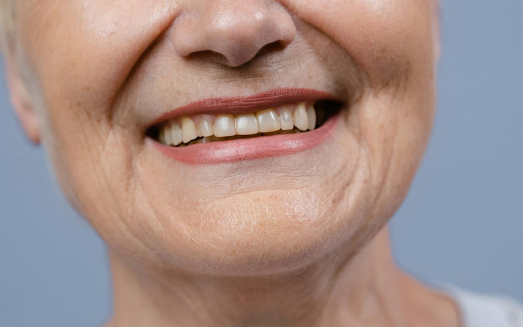 All You Need To Know About Wrinkle Treatment